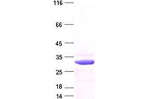 Western Blotting (WB) image for Cyclin-Dependent Kinase Inhibitor 1B (p27, Kip1) (CDKN1B) protein (DYKDDDDK Tag) (ABIN2713877)