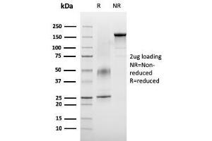 SDS-PAGE Analysis Purified VISTA Monospecific Mouse Monoclonal Antibody (VISTA/3007). (VISTA Antikörper)