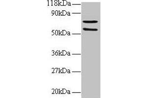 Western blot All lanes: SDHA antibody at 2 μg/mL + 293T whole cell lysate Secondary Goat polyclonal to rabbit IgG at 1/15000 dilution Predicted band size: 73, 68, 57 kDa Observed band size: 73, 57 kDa (SDHA Antikörper  (AA 44-293))