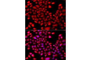 Immunofluorescence analysis of A549 cells using RARG antibody (ABIN5975541).