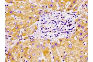 Immunohistochemistry of paraffin-embedded human liver tissue using ABIN7149238 at dilution of 1:100 (CYP2B6 Antikörper  (AA 250-343))