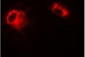 Immunofluorescent analysis of LDHA staining in A549 cells. (Lactate Dehydrogenase A Antikörper)