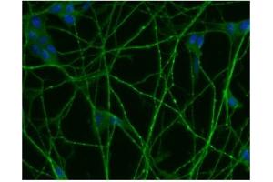 Immunofluorescence (IF) image for anti-Small Nuclear Ribonucleoprotein Polypeptide N (SNRPN) (AA 14-174) antibody (ABIN968086)