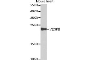 Western blot analysis of extracts of mouse heart cell lines, using VEGFB antibody. (VEGFB Antikörper)