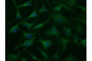 Anti-DYNC1LI1 mouse monoclonal antibody (ABIN2452964) immunofluorescent staining of COS7 cells transiently transfected by pCMV6-ENTRY DYNC1LI1 (RC222010). (DYNC1LI1 Antikörper)