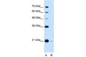 XTP3TPA antibody used at 0. (DCTPP1 Antikörper  (Middle Region))