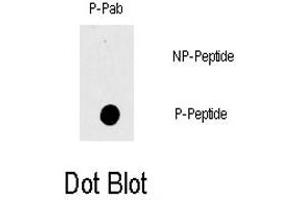Dot blot analysis of RAF1 (phospho T269) polyclonal antibody  on nitrocellulose membrane. (RAF1 Antikörper  (pThr269))