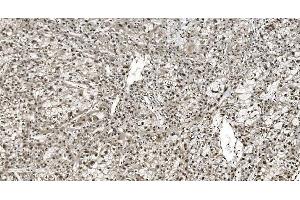 IHC analysis of HNRNPH3 using anti-HNRNPH3 antibody (ABIN7601121).