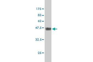 Western Blotting (WB) image for anti-Coagulation Factor II (thrombin) (F2) (AA 263-362) antibody (ABIN560822)