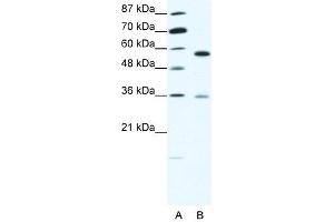 GDI1 antibody (20R-1348) used at 0. (GDI1 Antikörper  (C-Term))