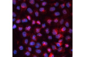 IF analysis of TFRC using anti-TFRC antibody (ABIN3043538). (Transferrin Receptor Antikörper  (AA 1-198))