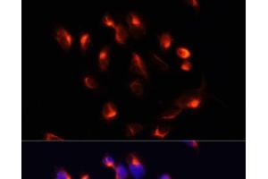 Immunofluorescence analysis of U2OS cells using CYP3A4 Polyclonal Antibody at dilution of 1:100. (CYP3A4 Antikörper)