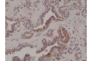 Immunohistochemistry (IHC) image for anti-Eukaryotic Translation Initiation Factor 2A, 65kDa (EIF2A) (pSer51) antibody (ABIN5708157)