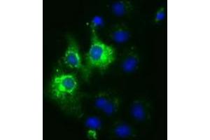 Anti-CYB5R3 mouse monoclonal antibody (ABIN2452925) immunofluorescent staining of COS7 cells transiently transfected by pCMV6-ENTRY CYB5R3 (RC201592). (CYB5R3 Antikörper)