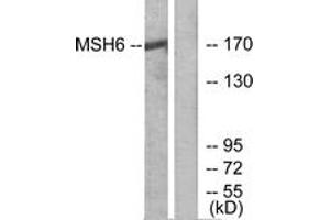 Western blot analysis of extracts from HuvEc cells, using MSH6 Antibody. (MSH6 Antikörper  (AA 341-390))