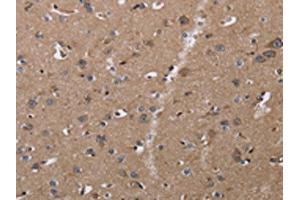 The image on the left is immunohistochemistry of paraffin-embedded Human brain tissue using ABIN7128954(CLDN23 Antibody) at dilution 1/30, on the right is treated with fusion protein. (Claudin 23 Antikörper)