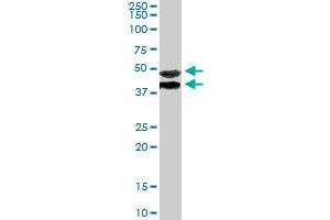 TRIM54 polyclonal antibody  staining (1ug/ml) of human muscle lysate (RIPA buffer, 35ug total protein per lane) . (TRIM54 Antikörper)