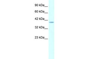 Human Daudi; WB Suggested Anti-HMX1 AntibodyTitration: 5. (HMX1 Antikörper  (Middle Region))