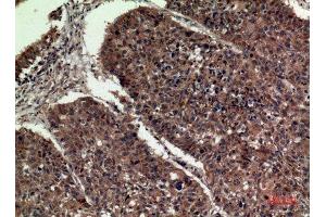 Immunohistochemistry (IHC) analysis of paraffin-embedded Human Lung, antibody was diluted at 1:100. (APOA1 Antikörper  (Internal Region))