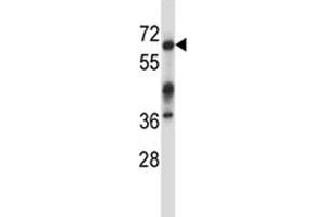 Irak3 antibody western blot analysis in mouse kidney tissue lysate. (IRAK3 Antikörper  (AA 517-544))