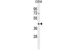 ACTBL3 Antibody (N-term) western blot analysis in CEM cell line lysates (35µg/lane). (ACTBL3 Antikörper  (N-Term))