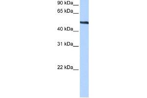 WB Suggested Anti-TRIP6 Antibody Titration:  0. (TRIP6 Antikörper  (Middle Region))