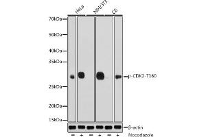 Western blot analysis of extracts of various cell lines, using Phospho-CDK2-T160 antibody (ABIN3020138, ABIN3020139, ABIN3020140, ABIN1681460 and ABIN1681461) at 1:1000 dilution. (CDK2 Antikörper  (pThr160))