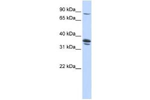 Western Blotting (WB) image for anti-Solute Carrier Organic Anion Transporter Family, Member 3A1 (SLCO3A1) antibody (ABIN2458794)