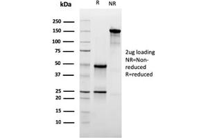 SDS-PAGE Analysis Purified CD47 Mouse Monoclonal Antibody (IAP/3019). (CD47 Antikörper  (AA 18-135))