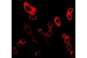 Immunofluorescent analysis of mPR gamma staining in LOVO cells. (PAQR5 Antikörper  (C-Term))