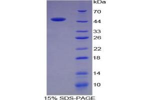 SDS-PAGE analysis of Rat Chromogranin B Protein.