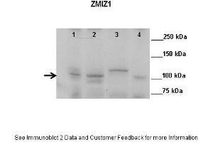 Western Blotting (WB) image for anti-Zinc Finger, MIZ-Type Containing 1 (ZMIZ1) (N-Term) antibody (ABIN2781101)