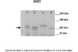 Lanes:   Lane 1: 50ug mouse retina extract Lane 2: 50ug mouse prostate extract Lane 3: 50ug mouse testis extract Lane 4: 50ug mouse colon extract  Primary Antibody Dilution:    1:1000  Secondary Antibody:   Anti-rabbit HRP  Secondary Antibody Dilution:    1:10,000  Gene Name:   ZMIZ1  Submitted by:   John Fu, UVA (ZMIZ1 Antikörper  (N-Term))