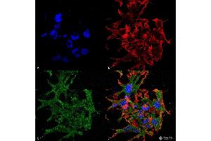 Immunocytochemistry/Immunofluorescence analysis using Mouse Anti-GABA-B Receptor 1 Monoclonal Antibody, Clone S93A-49 . (GABBR1 Antikörper  (AA 873-977) (Atto 594))