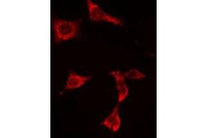 ABIN6274936 staining  HuvEc cells by IF/ICC. (PNPLA8 Antikörper  (C-Term))