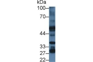 Detection of PSR in Mouse Liver lysate using Polyclonal Antibody to Phosphatidylserine Receptor (PSR) (JMJD6 Antikörper  (AA 1-334))
