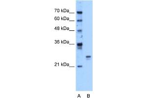 WB Suggested Anti-HMGB1 Antibody Titration:  1. (HMGB1 Antikörper  (Middle Region))