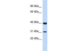 ZNF660 antibody used at 5 ug/ml to detect target protein. (ZNF660 Antikörper  (N-Term))