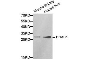 Western blot analysis of extracts of various cell lines, using EBAG9 antibody (ABIN5970999) at 1/1000 dilution. (RCAS1 Antikörper)