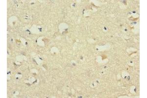 Immunohistochemistry (IHC) image for anti-Cadherin 1, Type 1, E-Cadherin (Epithelial) (CDH1) (AA 20-260) antibody (ABIN7146199)