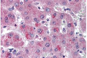 Human Liver (formalin-fixed, paraffin-embedded) stained with HTRA3 antibody ABIN296848 at 10 ug/ml followed by biotinylated goat anti-rabbit IgG secondary antibody ABIN481713, alkaline phosphatase-streptavidin and chromogen. (HTRA3 Antikörper  (AA 250-300))