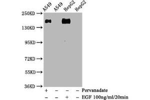 Western Blot Positive WB detected in A549 whole cell lysate 72epG2 whole cell lysate(treated with EGF or Pervanadate) All lanes Phospho-EGFR antibody at 1. (Rekombinanter EGFR Antikörper  (pTyr1068))