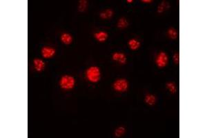 Immunofluorescent analysis of HOXA1 staining in HeLa cells.
