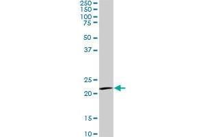 IL20 monoclonal antibody (M01), clone 2H8. (IL-20 Antikörper  (AA 67-176))