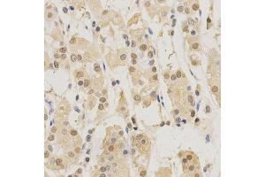 Immunohistochemistry (Paraffin-embedded Sections) (IHC (p)) image for anti-Proteasome (Prosome, Macropain) Subunit, beta Type, 5 (PSMB5) (AA 1-263) antibody (ABIN3022702)