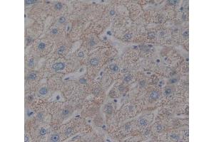 Immunohistochemistry (IHC) image for anti-Hemochromatosis Type 2 (Juvenile) (HFE2) (AA 36-200) antibody (ABIN5013687)