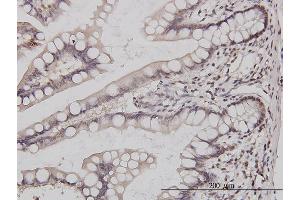 Immunoperoxidase of monoclonal antibody to GABPA on formalin-fixed paraffin-embedded human small Intestine. (GABPA Antikörper  (AA 1-100))