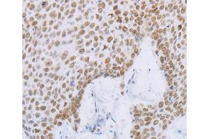 Immunohistochemistry (IHC) image for anti-Minichromosome Maintenance Complex Component 2 (MCM2) antibody (ABIN2428398) (MCM2 Antikörper)