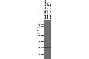 Immunoblot versus brain samples from adult rat (RBLSP) and GFAP wild- type (WT), knockout (KO) and R416W KI mice.