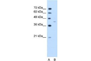 WB Suggested Anti-GNAS Antibody Titration:  2. (GNAS Antikörper  (C-Term))